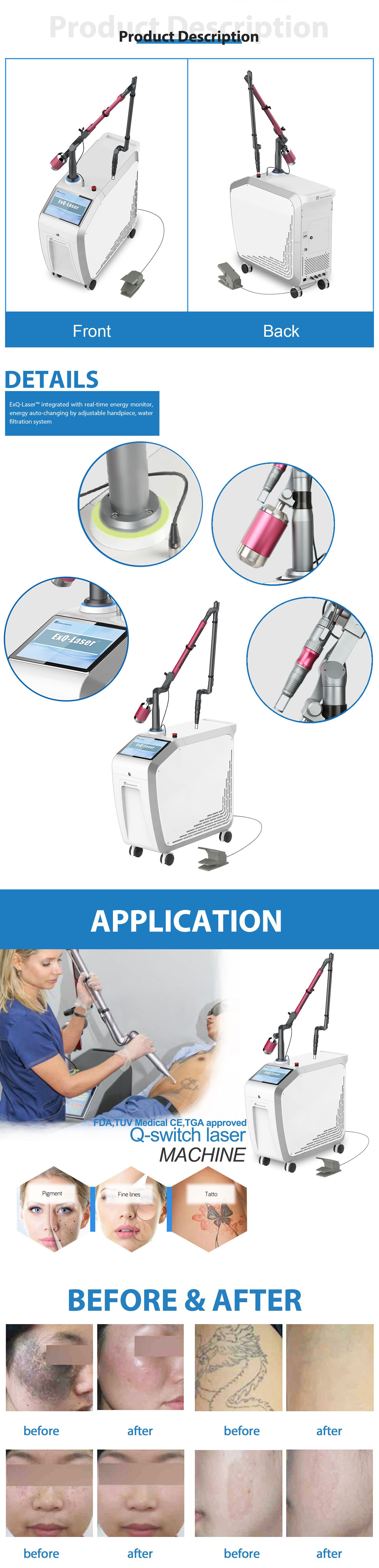 Pigmented Lesions therapy/faciall carbon peeling skin rejuvenation Q switched ND: YAG Laser beauty machine ( Medical CE, TGA)