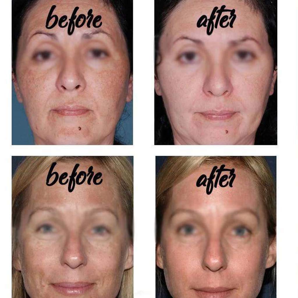 Organic Moisturizing and Brightening Hyaluronic Acid Ampoules Niacinamide Face Essence