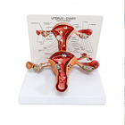 medical teaching used human uterus pathological model