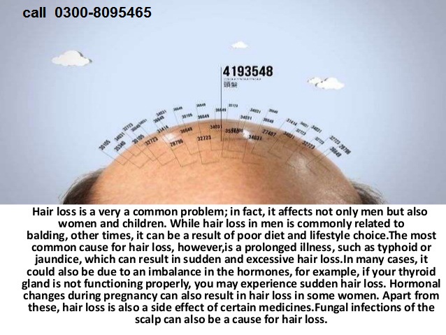 3 Nutrifolica Hair Regrowth Growth Shampoo Natural Stop Loss Thin