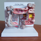 PVC human anatomy colon pathology model for medical teaching and training