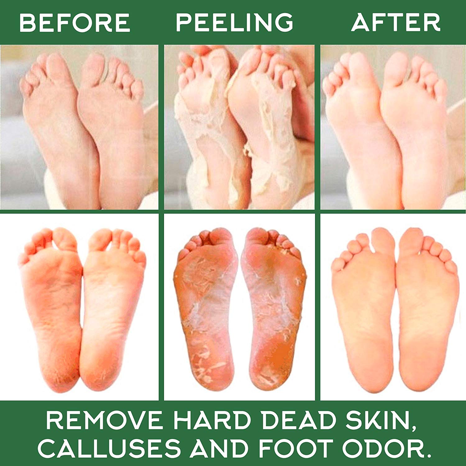 Foot Skin Care callus removal Exfoliating Aloe Vera Foot Feel Mask