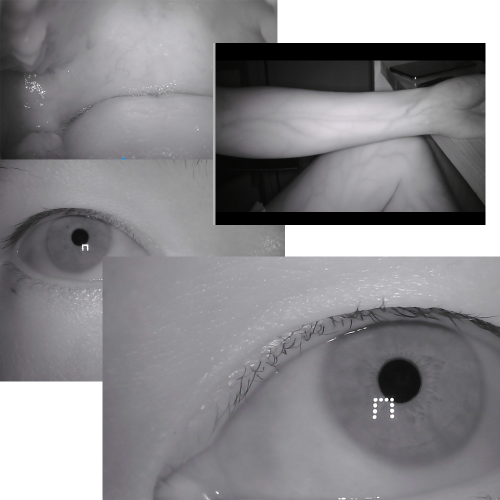 HQCAM 2MP Medical Camera Vein Shooting Iris Shooting USB Medical Infrared Camera liveness detection Narrow band filter