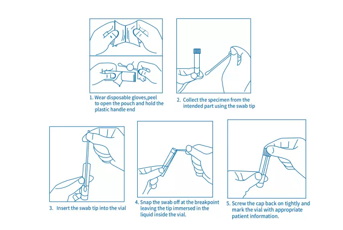 Nasopharyngeal Cervicale Mondelinge Steriele Bijeengekomen Neus de Zwabber Nylon Vervoer van de keelneus 9