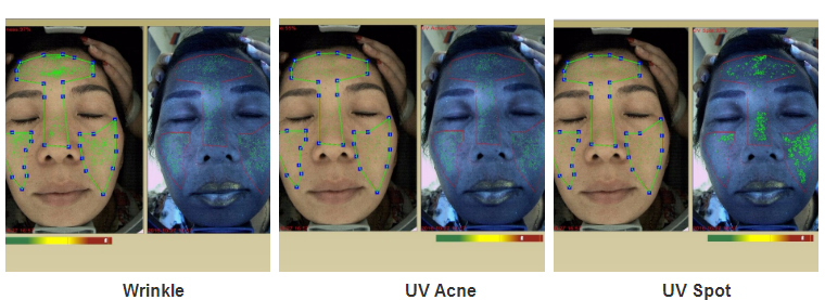 Best Sell Facial Skin Analyzer Machine in the world