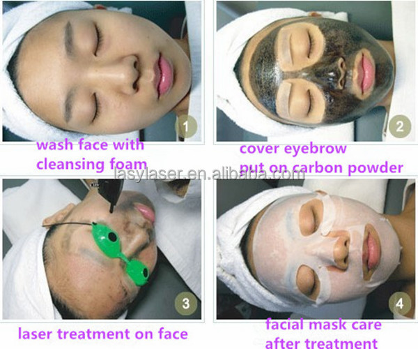 Лазер Nd Yag переключателя Microblading q