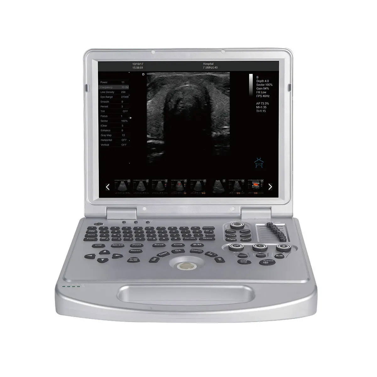Dawei Best Portable Veterinary Ultrasound Scanner System with Convex Probe