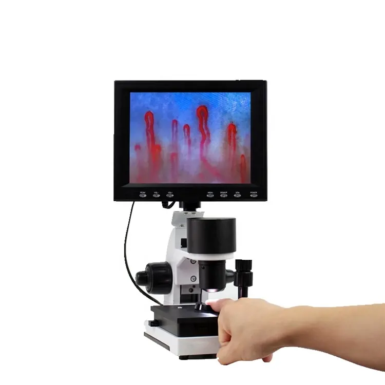 Аппарат для микроциркуляции крови/микроскоп для анализа крови для лаборатории MSLXW01
