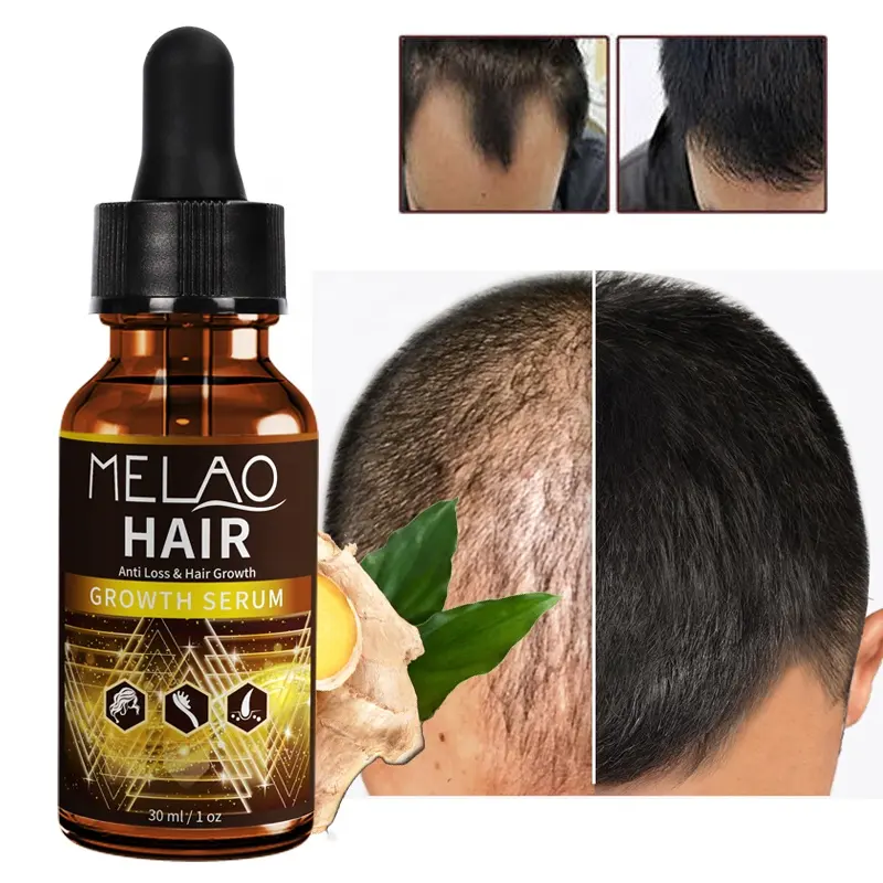 Натуральная Органическая веганская Сыворотка для роста волос MELAO органическое питающее масло для ухода за волосами кожи головы 30 мл OEM Сыворотка для роста волос