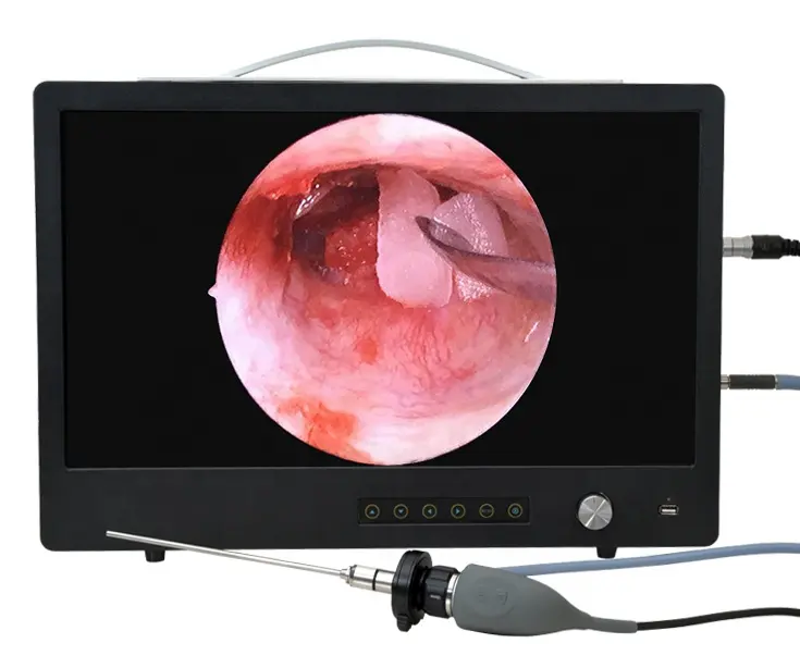 Full HD Medical ENT endoscope camera