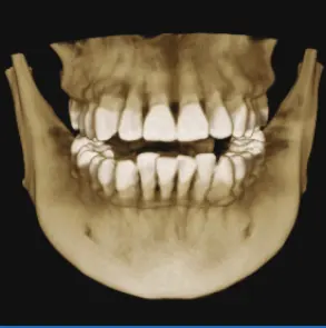 HiRes3D-Plus Digital Professional x-ray dental CT with 3D face scan