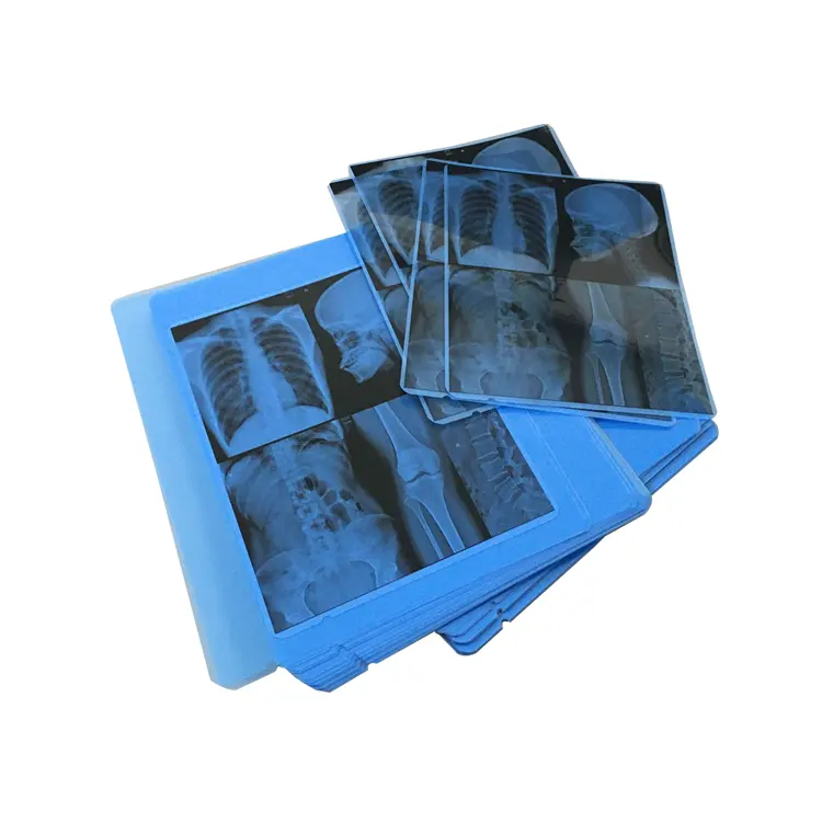 Оптовая продажа с завода Nanjing, точное и реальное изображение, синяя стоматологическая рентгеновская пленка для принтера Kodak