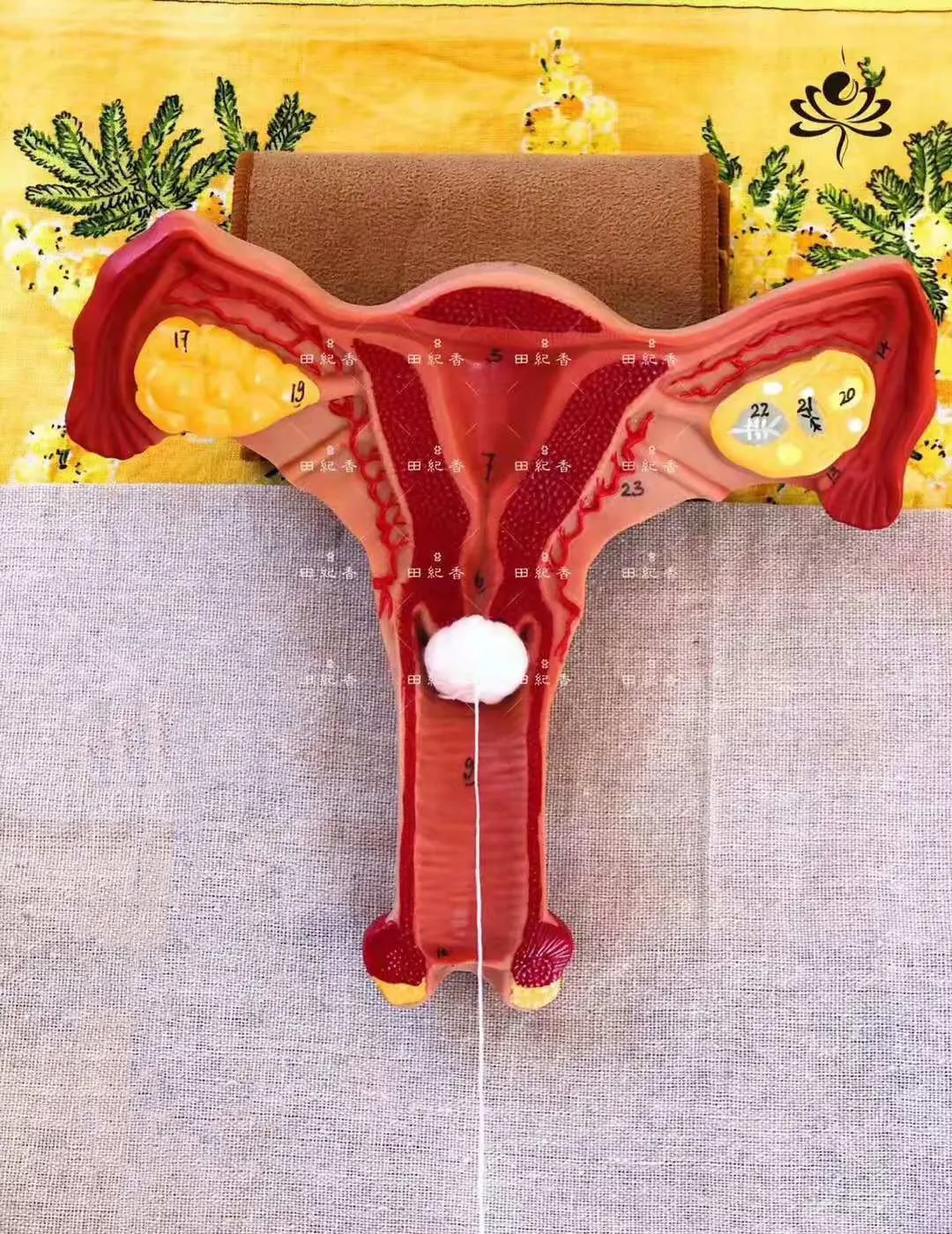Gynecological Supplies To Regulate Uterine Fibroids To Treat Women's Infertility And Dredge The Fallopian Tube