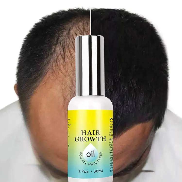 private label 7 Days Germinal Oil For Men hair loss products coffee coffeine biotin Hair Growth Serum oil