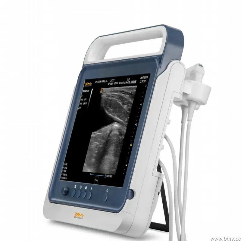 Chinese medical laptop diagnostic ultrasound portable scanners with 3 probe connector, usb, fda approval