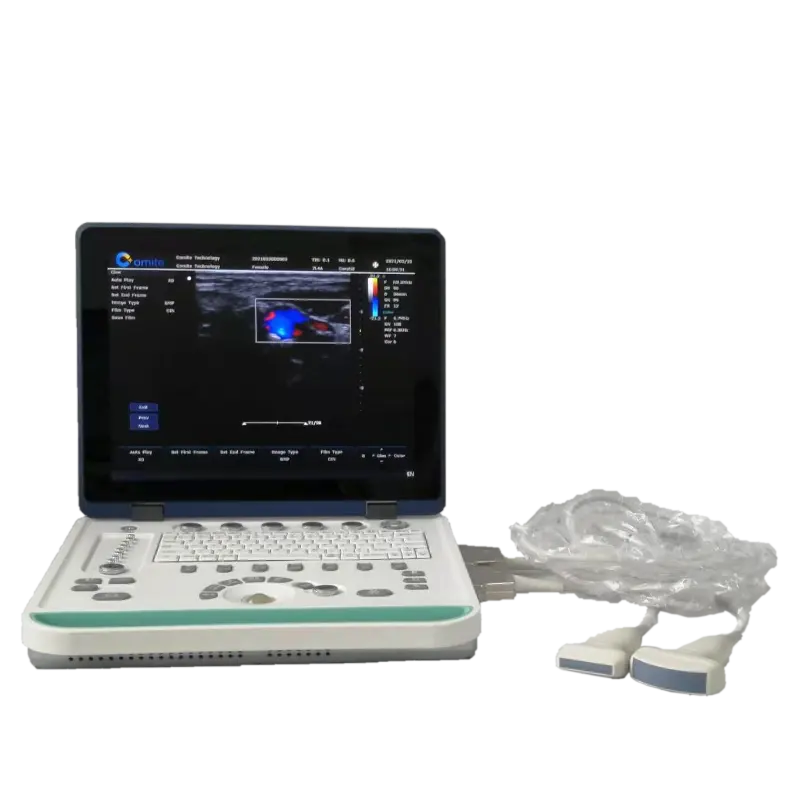 Недорогой портативный цветной Доплеровский Ультразвуковой Сканер зонды 3D 4D ноутбук