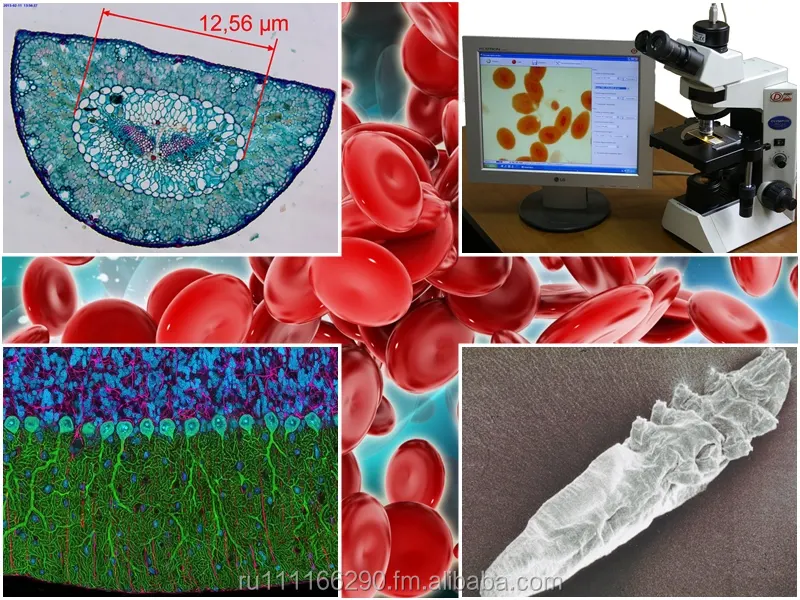 Dianel-Micro-software for automation,visualization,classification and evaluation of laboratory researches on digital microscope