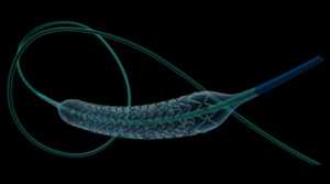 สายสวนหลอดเลือดแดงปอดแบบใช้แล้วทิ้งทางการแพทย์ได้รับการออกแบบการตรวจสอบการไหลเวียนโลหิตในผู้ป่วยหนักและหน่วยผ่าตัด - Product Image 3