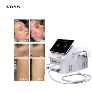 ADSS IPL Opt E luce con rimozione dei capelli in modalità rapido movimento dinamico Pulse luce della pelle macchina di ringiovanimento - Product Image 4