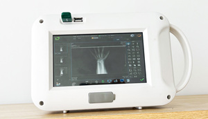 Handheld Xray Machine with Flat Panel Detector Built in <strong>Computer</strong> X Ray Machine Digital Radiography <strong>System</strong> for Hospital - Product Image 4