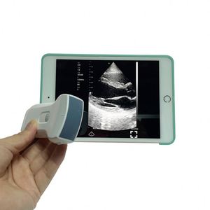 高性价比双探头无线彩色多普勒超声仪凸线性探头带凸线性探头 - Product Image 5