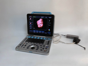 เครื่องสแกนอัลตร้าซาวด์จอใหญ่4D 5D ทารกในครรภ์แบบพกพาสี Doppler - Product Image 2