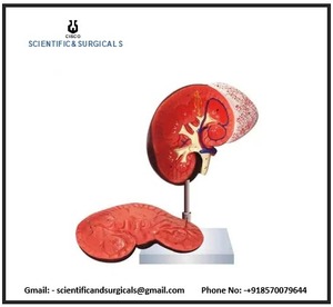 腎臓モデルを使用した人間の腎臓は、腎臓皮質のデモンストレーションに役立つ2つの部分に分けることができます