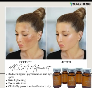 Yüksek kalite standart 50mL Melanoout Serum ampülleri kaldırmak için melazma ve beyazlatmak cilt tonu seti 5 Serum ampul - Product Image 3