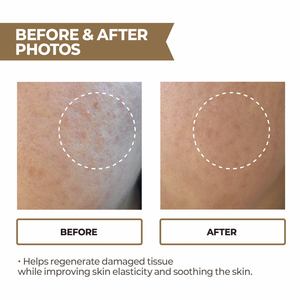 Singredient pdrn RX DNA lỏng cho khuôn mặt chống lão hóa nuôi dưỡng Công ty & làn da mịn màng cho phụ nữ - Product Image 3