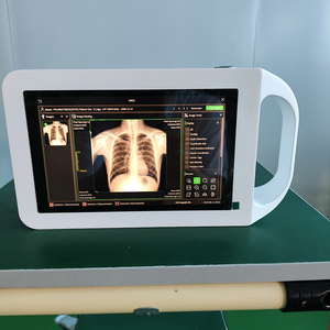 The Medical Portable X-ray Machine <strong>for</strong> Inspecting Comes with <strong>Computer</strong> <strong>Operating</strong> <strong>System</strong> MSLGX26. - Product Image 3