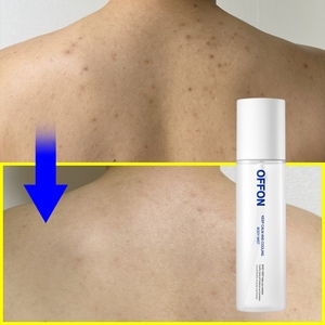 Offon Blijf Kalm En Verkoelend Acne Behandeling Vochtinbrengende Lichaamsmist 150Ml Hydratatie Snelle Absorptie - Product Image 6