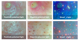 AI Intelligent Skin Analysis <strong>Imager</strong> Is Designed to Address Skin Concerns, Integrating <strong>Eight</strong> Spectral <strong>Imaging</strong> Technologies - Product Image 4