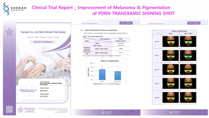 Huyết thanh dưỡng da SKIN BY HOME PDRN Plus Tranexamic Shining Shot (PDRN 75.000 ppm) - Product Image 3