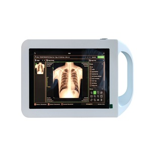 The Medical Portable X-ray Machine <strong>for</strong> Inspecting Comes with <strong>Computer</strong> <strong>Operating</strong> <strong>System</strong> MSLGX26. - Product Image 2
