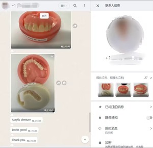 Dental Monolayer PMMA <strong>Block</strong> Pink With Vein, 98mm 95mm AG Pink 16 <strong>Color</strong> A0 A1 A2 A3 A4 CADCAM Temporary Denture Dental PMMA Resin