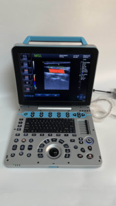 เครื่องสแกนอัลตร้าซาวด์จอใหญ่4D 5D ทารกในครรภ์แบบพกพาสี Doppler - Product Image 3