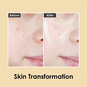 Hàn Quốc chăm sóc da mỹ phẩm Sản phẩm làm đẹp chống lão hóa chống nếp nhăn mặt huyết thanh medipeel sang trọng 24K vàng Ampoule 100ml - Product Image 5