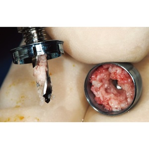 (Acrodent) GBR bút Chất lượng cao nha khoa phẫu thuật cụ sản xuất tại Hàn Quốc phẫu thuật thiết bị cho nha sĩ - Product Image 6