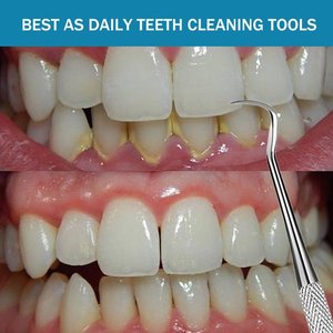 Frazier hút ống dụng cụ nha khoa, thép không gỉ đầu dò Nha khoa Răng Picks, Độ chính xác đo lường thiết kế nha sĩ công cụ thiết lập - Product Image 4