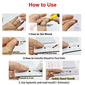 IVDラボABO急速テストキット人間の血液型グループ化簡単な家庭用テストペット製品 - Product Image 2
