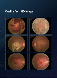 كيستريل ، غير ميدرياتيك ، مع تشغيل تلقائي بالكامل لفحص الشبكية بضمان لمدة سنة - Product Image 2