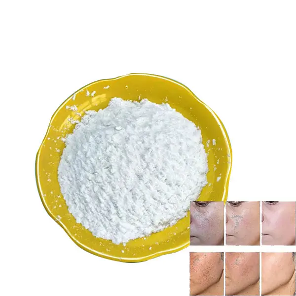 Matéria-prima cosmética por atacado CAS152312-71-5 potássio 2-hidroxi-4-metoxibenzoato 4MSK com clareamento e remoção de acne