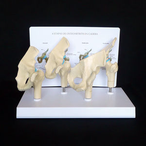 KyrenMed 4ステージ股関節変形性関節症解剖モデルヒト4ステージ関節炎ヒップモデル股関節変性骨格モデル - Product Image 4
