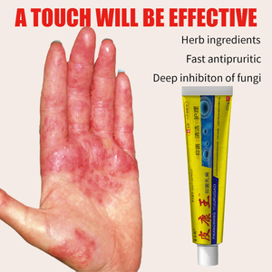 Smmlpunoem Pi kangwang Kem giảm đau da ướt ngứa Kem chống ngứa cho chợ đêm bán hàng bán buôn thương mại điện tử douyin - Product Image 3