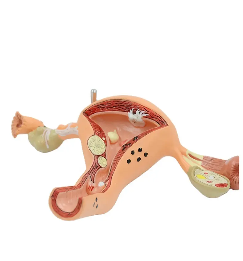 Modello di utero di patologia anatomica umana di alta qualità del modello di scienza medica