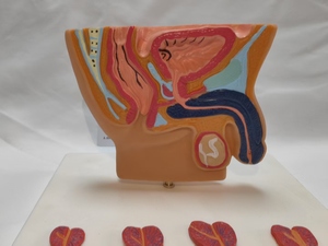 Human Male Abdominal Cavity Anatomical Model for Prostate &amp; Bladder Health Doctor Patient <strong>Explanation</strong> for Medical Teaching - Product Image 3