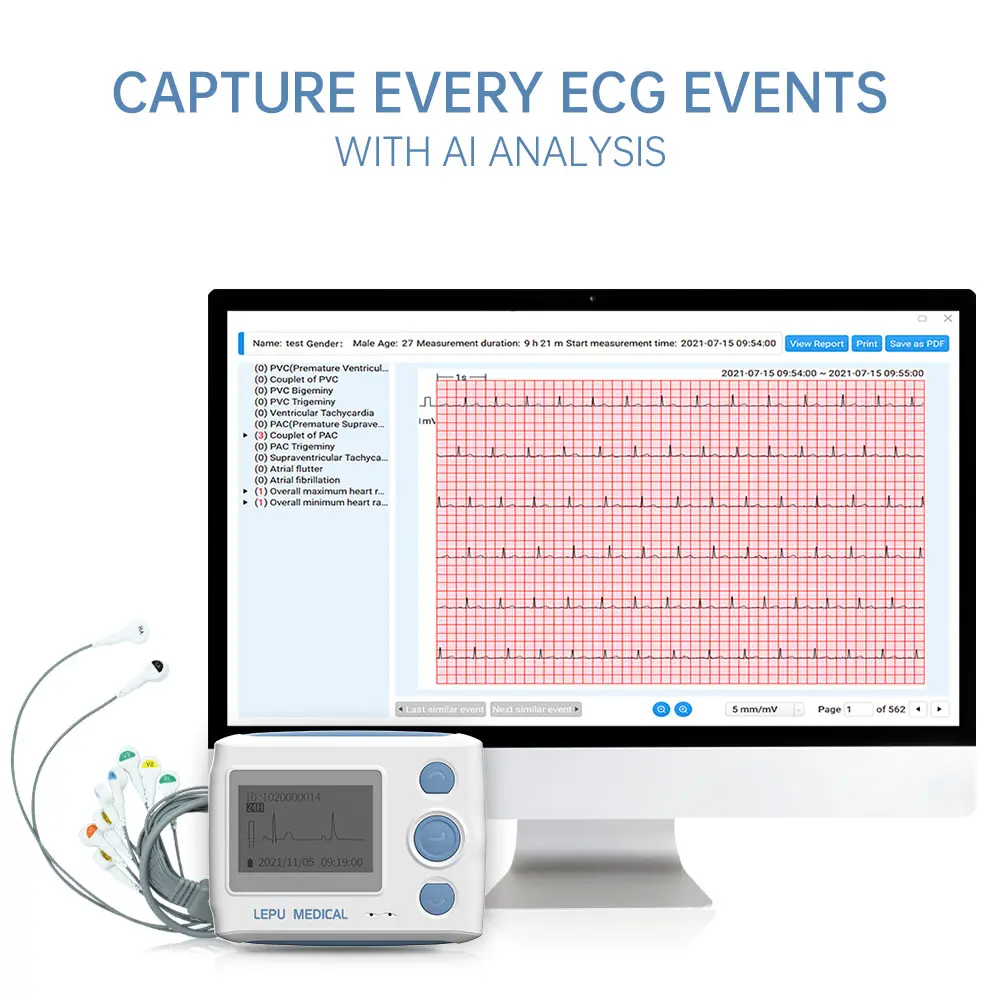 Viatom Th12 Holter Portátil Monitor Ecg Ambulatório 24 Horas de Freqüência Cardíaca Monitor Ecg Dinâmico Máquina 12 Canais