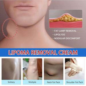 Hot Sale Lymphatic Detox Massage Cream Whitening & Soothing Fat Lump & Lipoma Removal for Body - Product Image 5