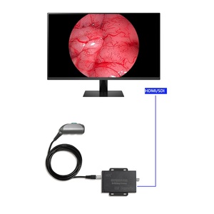 Адаптер 4K SDI-HDMI, мини видеопроцессор, медицинская камера, портативное устройство эндоскопа, аудио Sdi Hdmi конвертер - Product Image 1