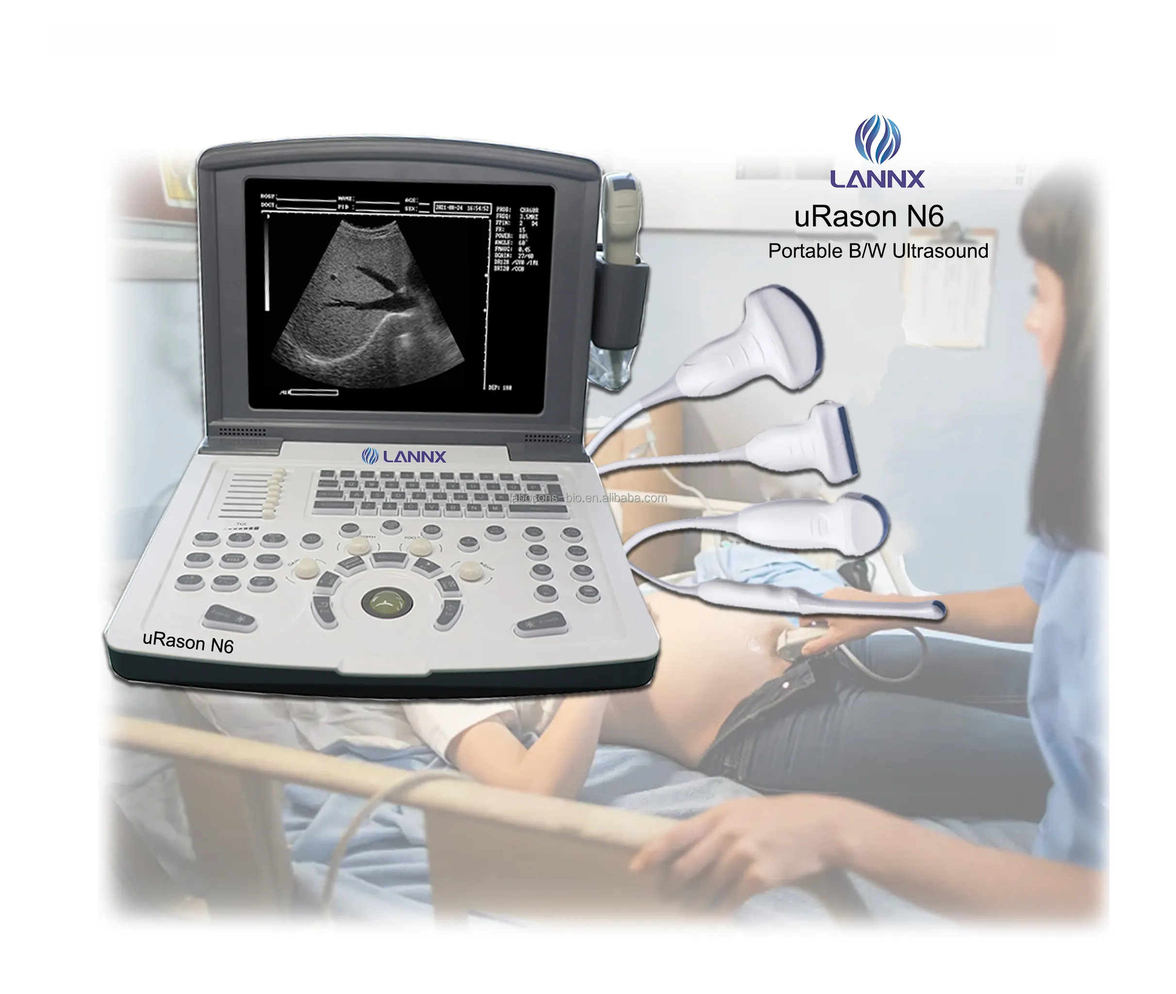 LANNX uRason N6 Automatische Identifikation sonde USG tragbarer Ultraschall der Ultraschall diagnose klinik für Schwangerschaft scanner